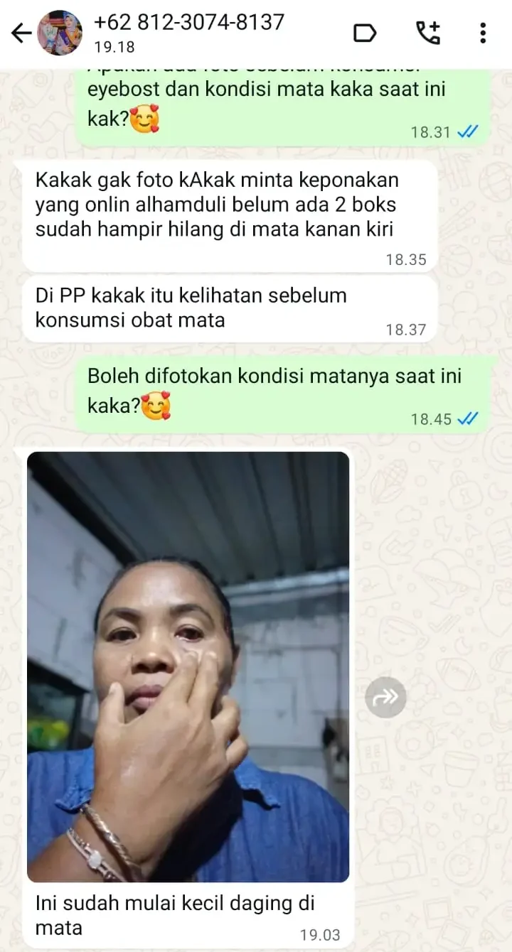 LEMAK-MATA-e1770515610935.webp