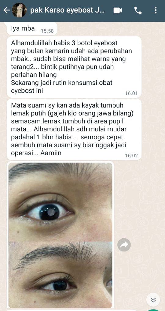 testi-katarak-1-e1770515655812.jpg