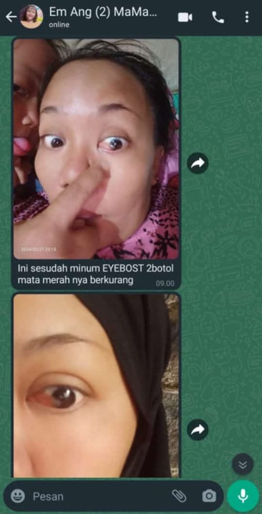 testi-lemak-mata-2--e1770515671416.jpg