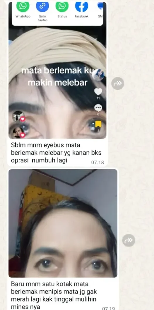 LEMAK-MATA-DAN-MINUS-e1770515872977.webp
