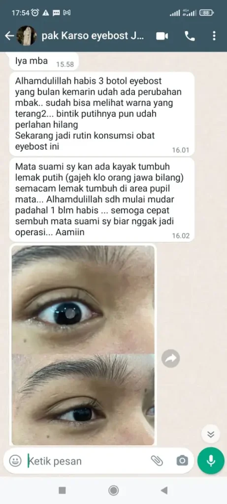 testi-katarak-1-1.webp
