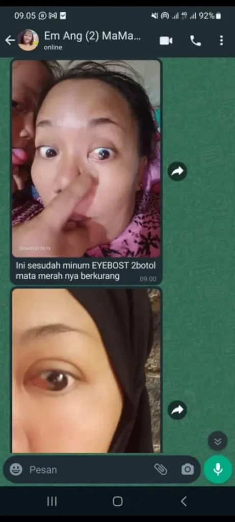 testi-lemak-mata-2-1-1.webp